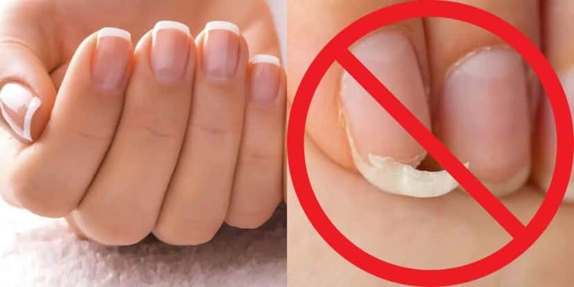Deixe as unhas fortes com 3 ingredientes naturais (Reprodução: Montagem TV Foco) Deixe as unhas fortes com 3 ingredientes naturais (Reprodução: Montagem TV Foco)