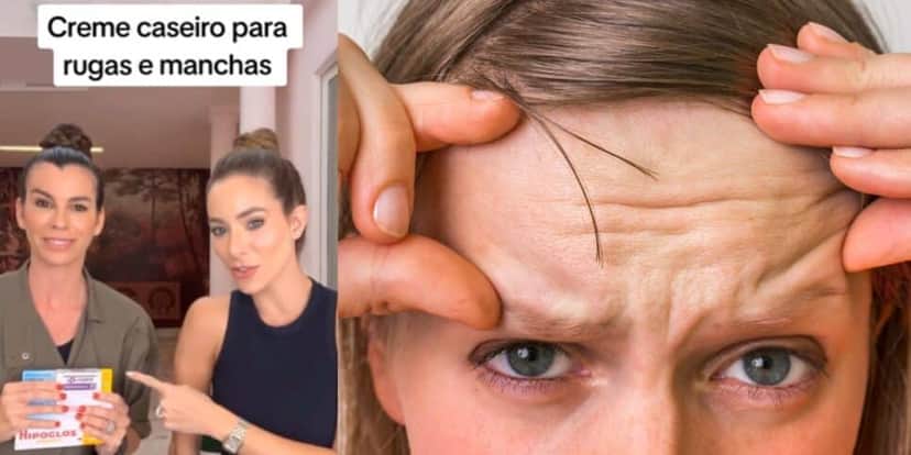 Produtos para fazer a pomada caseira (Reprodução: TikTok) Produtos para fazer a pomada caseira (Reprodução: TikTok)