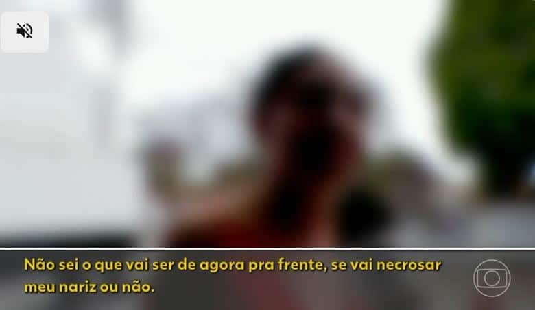 Depoimento de uma mulher que não quis se identificar, porém alega medo de necrose após procedimento (Foto Reprodução/Globo) Depoimento de uma mulher que não quis se identificar, porém alega medo de necrose após procedimento (Foto Reprodução/Globo)