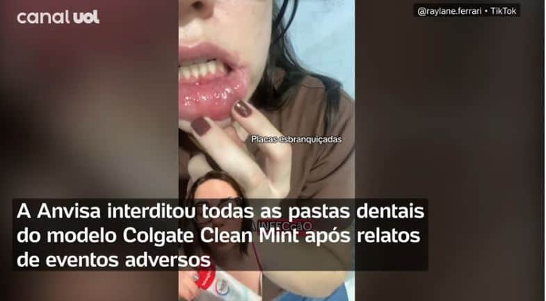 ANVISA entrou em cena após as pastas da marca serem denunciadas (Foto Reprodução/YouTube) ANVISA entrou em cena após as pastas da marca serem denunciadas (Foto Reprodução/YouTube)