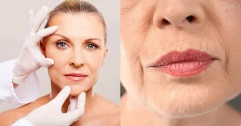 Harmonização caseira traz pele de porcelana às senhoras 60+ Harmonização caseira traz pele de porcelana às senhoras 60+