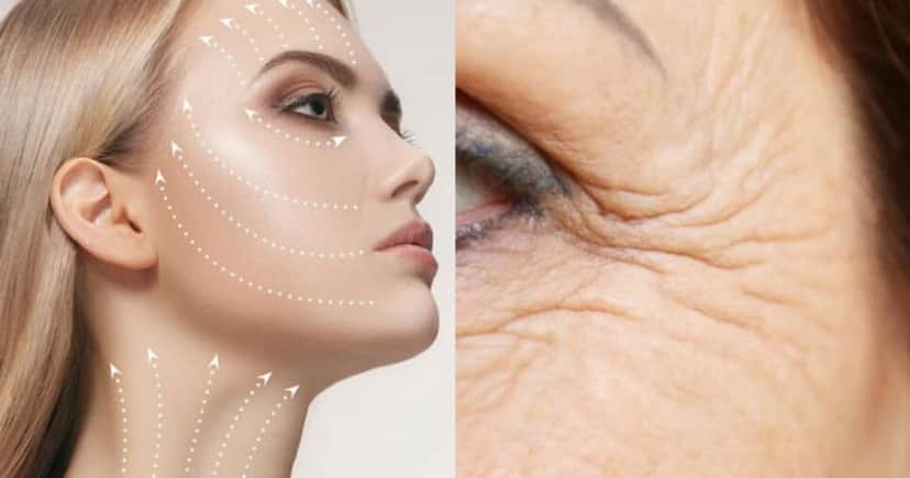 Lifting facial caseiro é possível com receita caseira (Foto: Montagem) Lifting facial caseiro é possível com receita caseira (Foto: Montagem)