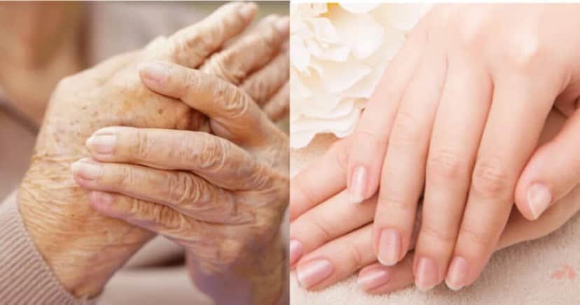 Mistura com 3 ingredientes traz FIM das rugas nas mãos - (Montagem / TV FOCO) Mistura com 3 ingredientes traz FIM das rugas nas mãos - (Montagem / TV FOCO)