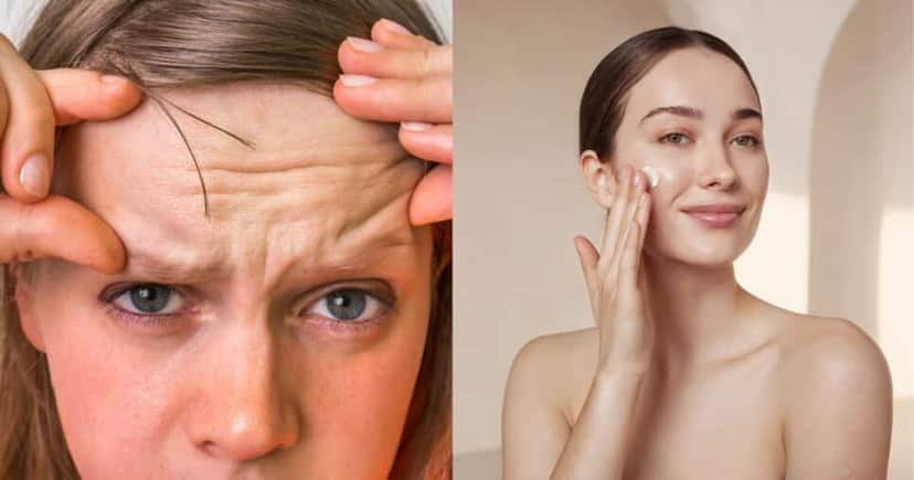 Pele sem rugas com receita melhor que colágeno - Foto Reprodução Internet Pele sem rugas com receita melhor que colágeno - Foto Reprodução Internet