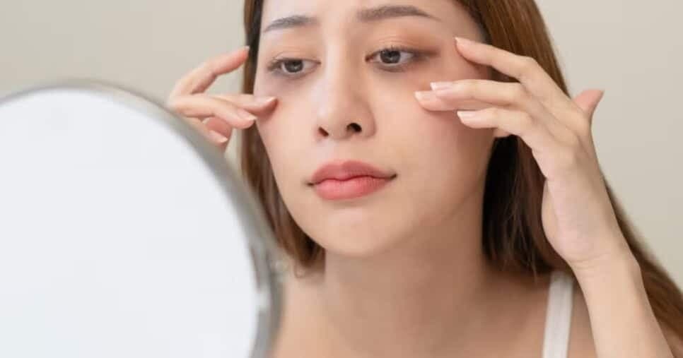 Cuidados simples: 5 hábitos diários para reduzir as olheiras