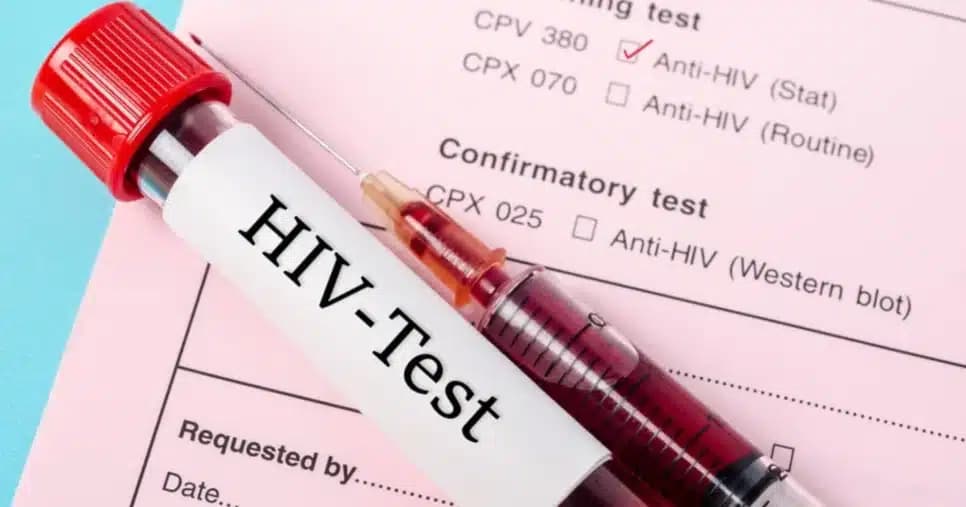 Sintomas iniciais do HIV são revelados e você precisa saber para agir