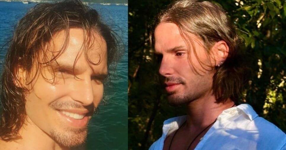 Jonatas Faro fez procedimento de harmonização facial (Foto Reprodução/Instagram @jonatasfaro) Jonatas Faro fez procedimento de harmonização facial (Foto Reprodução/Instagram @jonatasfaro)