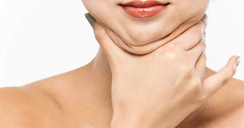 Como eliminar a papada (Foto: Divulgação) Como eliminar a papada (Foto: Divulgação)