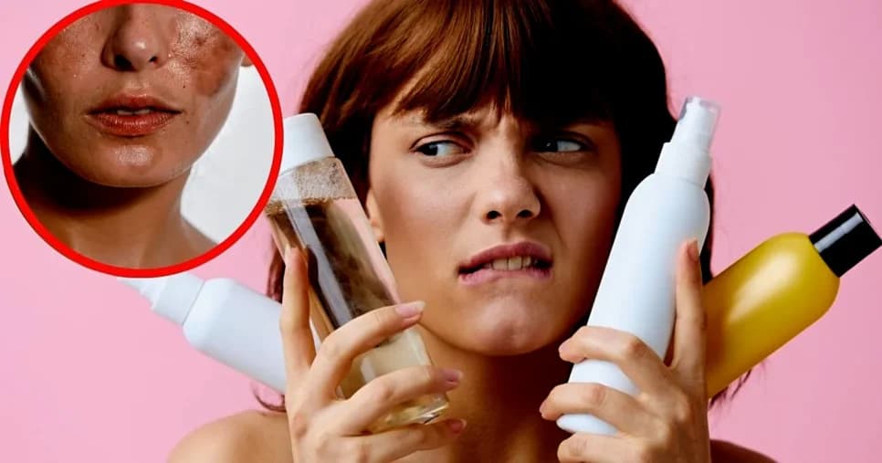 Efeito rebote: Único erro comum na rotina de skincare pode potencializar o surgimento de manchas e rugas