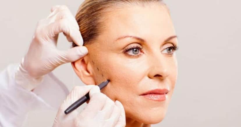 Lifting facial caseiro vai disparar o colágeno no seu rosto (Foto: Divulgação) Lifting facial caseiro vai disparar o colágeno no seu rosto (Foto: Divulgação)