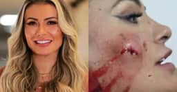 Cuspe na cara, surra em pancadaria e rosto ensanguentado: A briga feia de Andressa Urach com famosa