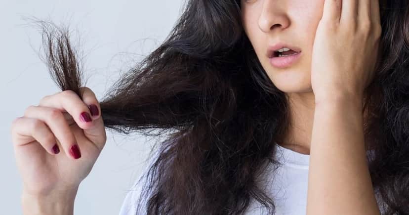 Cabelo ressecado no outono (Foto: Divulgação) Cabelo ressecado no outono (Foto: Divulgação)