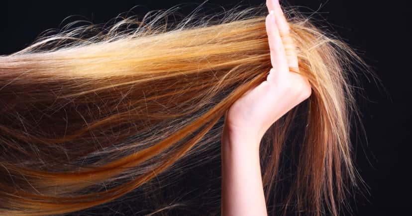 Frizz (Foto: Divulgação) Frizz (Foto: Divulgação)