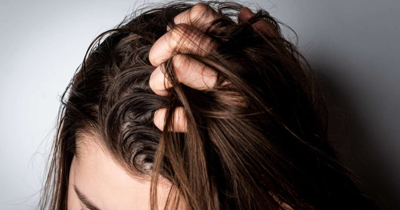 Cabelo sujo e com suor (Foto: Reprodução/Internet) Cabelo sujo e com suor (Foto: Reprodução/Internet)