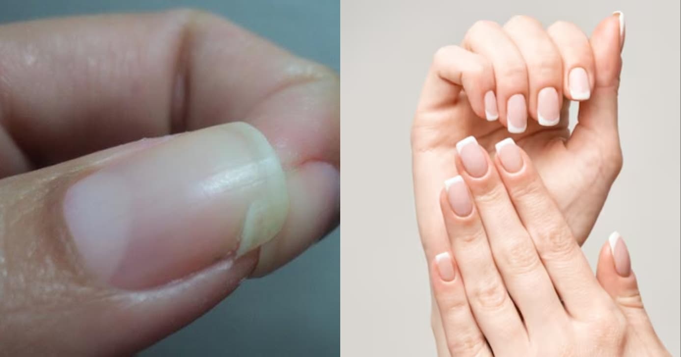 Segredo das manicures: Como remendar a unha quebrada e deixá-la igualada às demais
