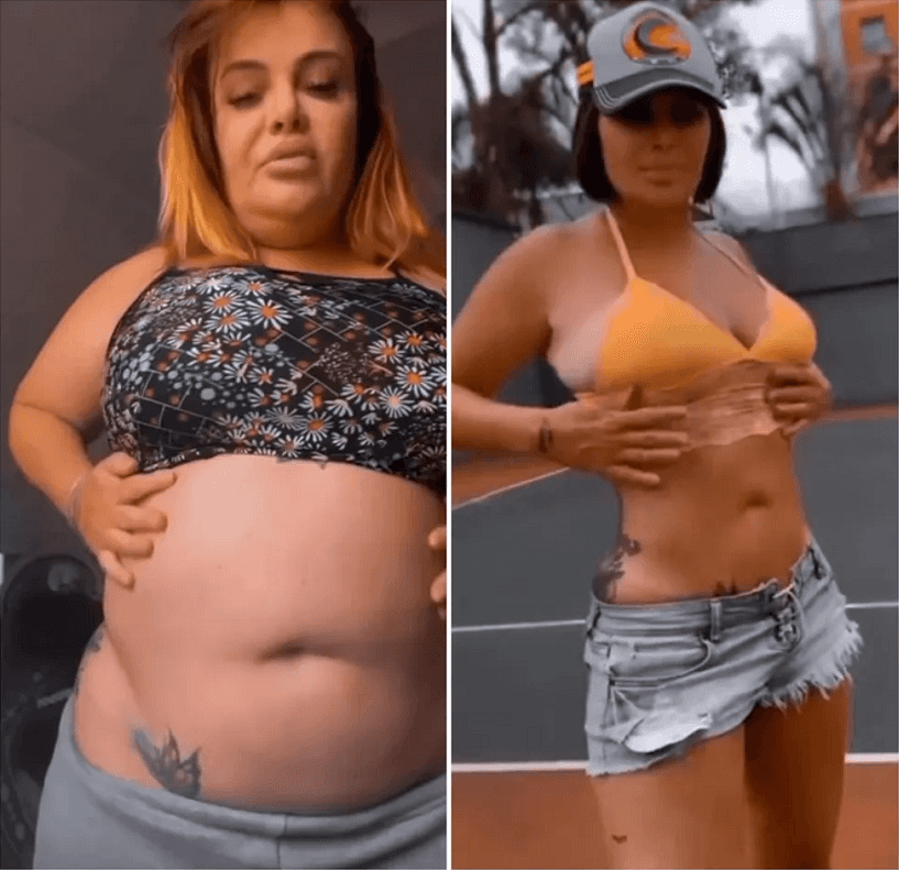 Valentina Francavilla antes de depois (Foto: Reprodução/ Instagram) Valentina Francavilla antes de depois (Foto: Reprodução/ Instagram)