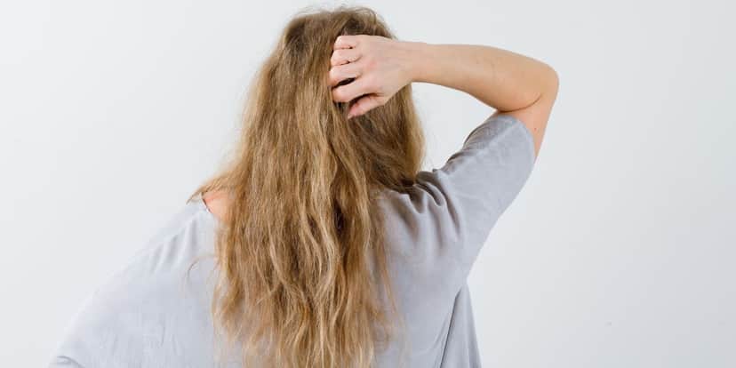 Cabelo seco causado por falta de oleosidade (Reprodução: Divulgação) Cabelo seco causado por falta de oleosidade (Reprodução: Divulgação)