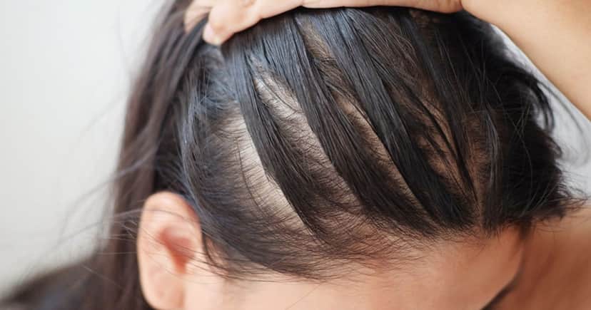 Confira se pode lavar o cabelo antes de pintar (Foto: Reprodução/ Internet) Confira se pode lavar o cabelo antes de pintar (Foto: Reprodução/ Internet)