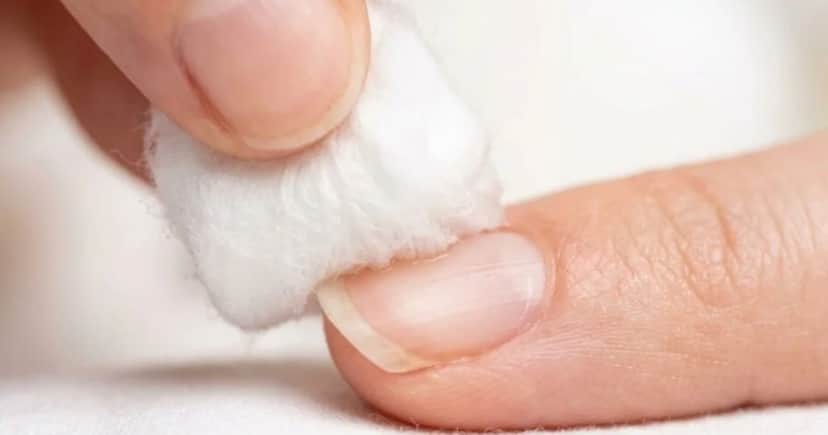 Umedeça levemente os dedos com vinagre branco e deixe secar (Foto Reprodução/Internet) Umedeça levemente os dedos com vinagre branco e deixe secar (Foto Reprodução/Internet)