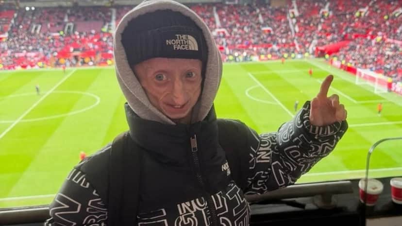 Morre o influenciador Michiel Vandeweert, que sofria de progeria, doença genética rara (Foto: Reprodução/ Instagram) Morre o influenciador Michiel Vandeweert, que sofria de progeria, doença genética rara (Foto: Reprodução/ Instagram)